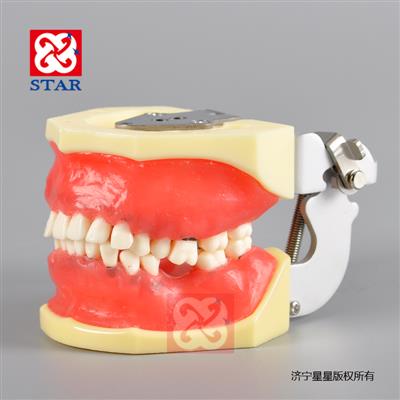 牙周病實習模型M4027