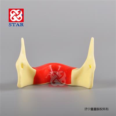 整體硬塑脂缺牙區填充仿骨質定位練習